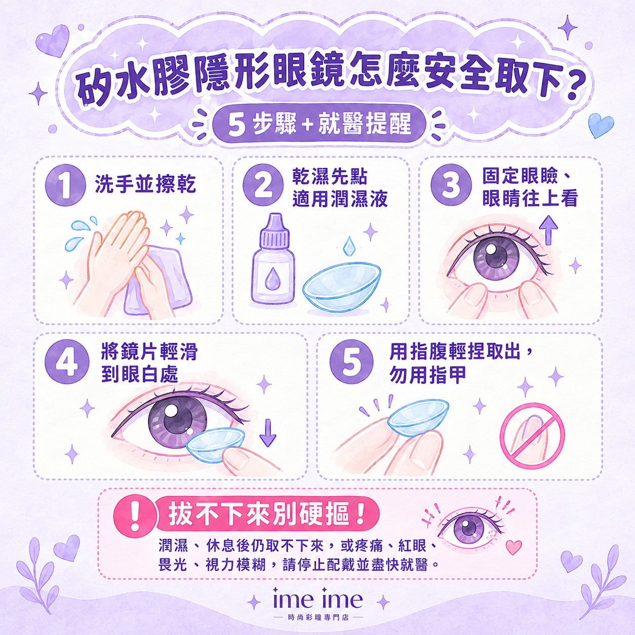 矽水膠隱形眼鏡怎麼取下?5 步驟圖解:清潔雙手、先潤濕眼睛與鏡片、固定眼瞼、把鏡片滑到眼白處、指腹輕捏取出