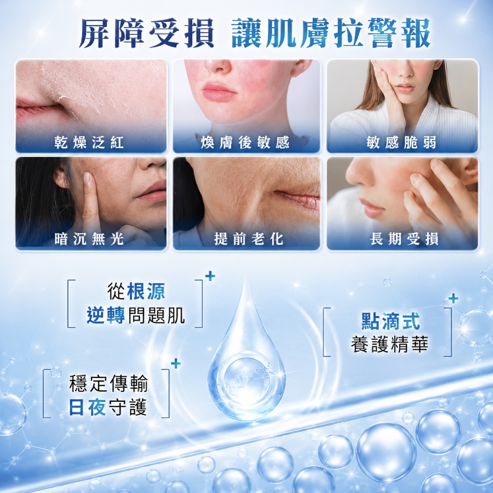 M161【SENSILIS森思黎絲】SOS極效舒緩修護精華,美容後保養,沒藥醇,屏障修護,曬後舒緩,刷酸修護